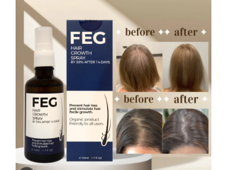 FEG Hair Growth Spray – Stop Hair Fall & Regrow Naturally | 03001819306